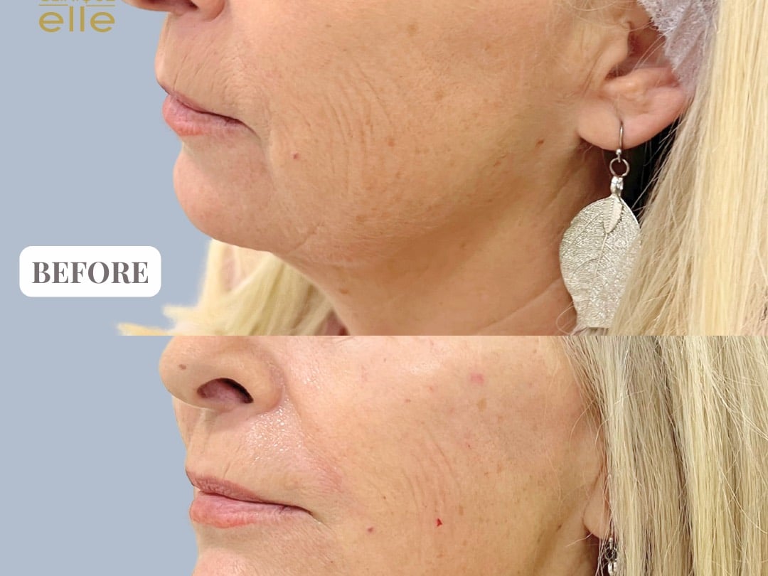 Clinique Elle - Skin Specialists in Umm Suqeim 2, Dubai