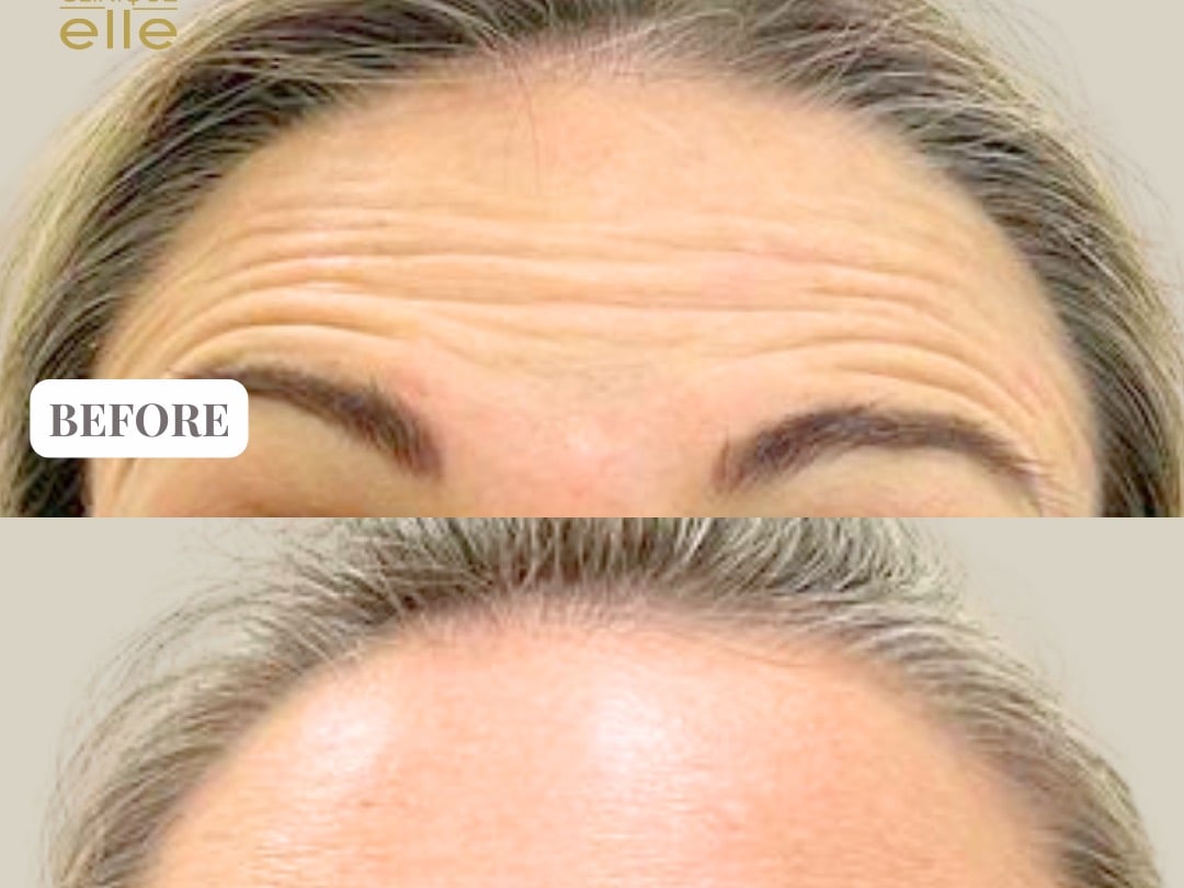 Clinique Elle - Skin Specialists in Umm Suqeim 2, Dubai