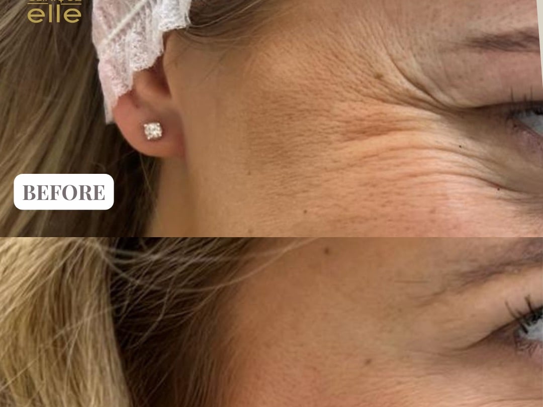 Clinique Elle - Skin Specialists in Umm Suqeim 2, Dubai