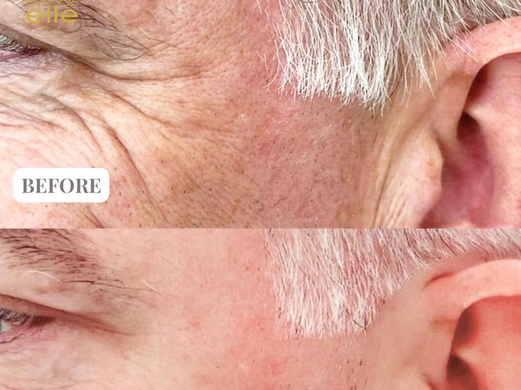 Clinique Elle - Skin Specialists in Umm Suqeim 2, Dubai
