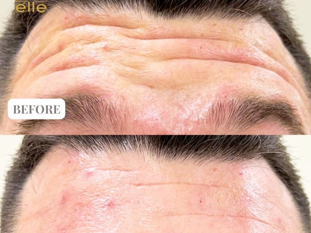 Clinique Elle - Skin Specialists in Umm Suqeim 2, Dubai