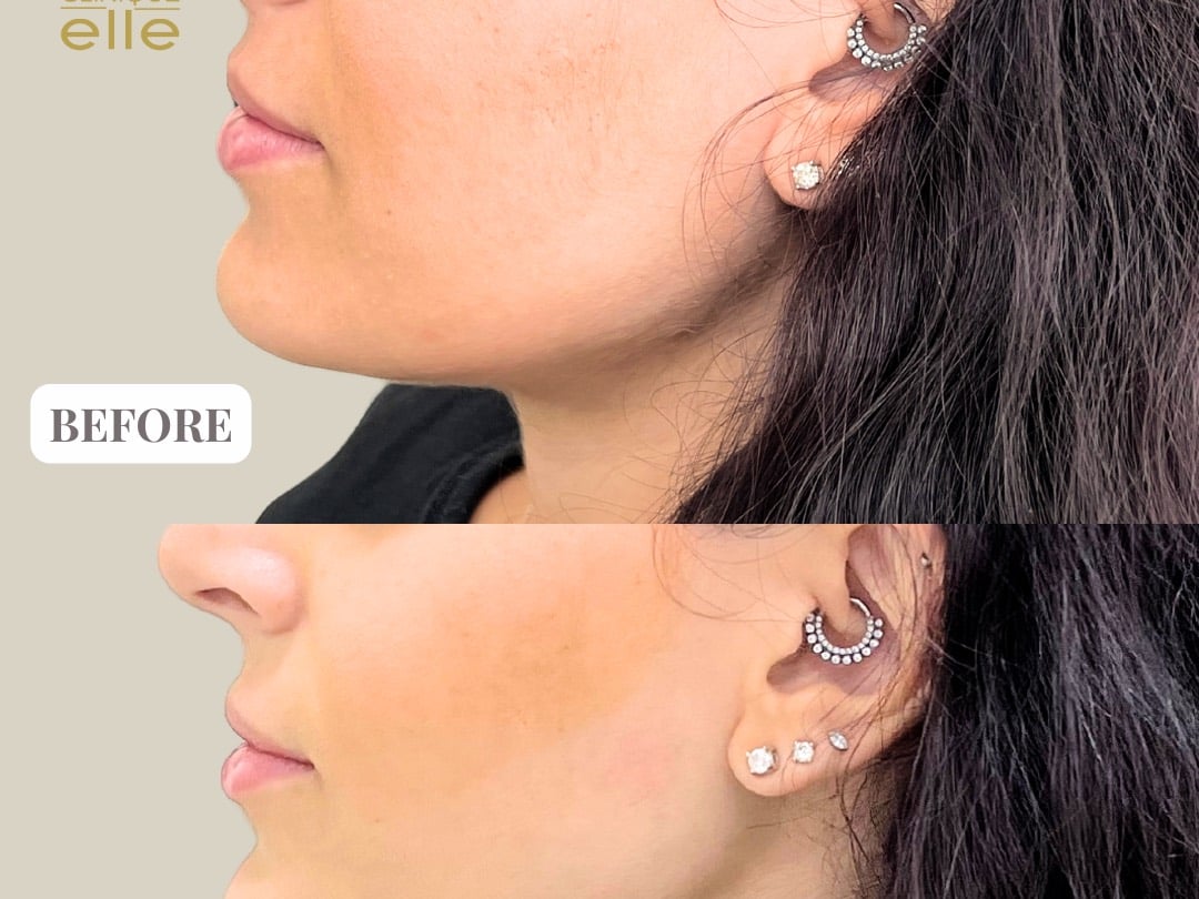 Clinique Elle - Skin Specialists in Umm Suqeim 2, Dubai